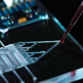 Microfluidics